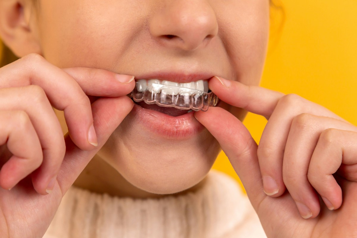 Representative dental care photograph