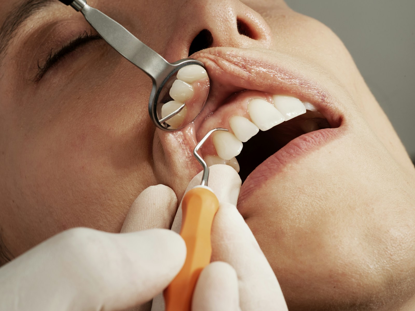 Representative dental care photograph