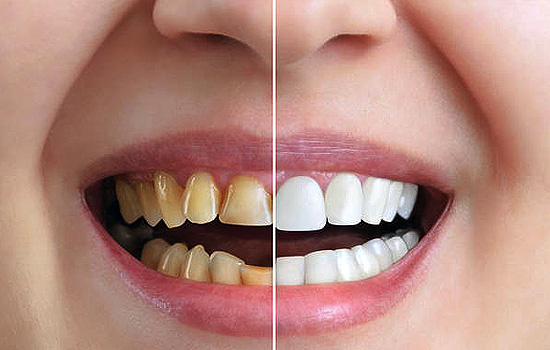 Cosmetic Dentistry — representative treatment image